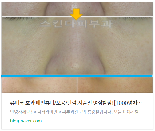 스킨부스터 비교 티어리스트 (11).png