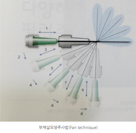 레디어스 부작용 (8).jpg