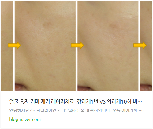 흑자 치료과정 후기 2편 (7).jpg