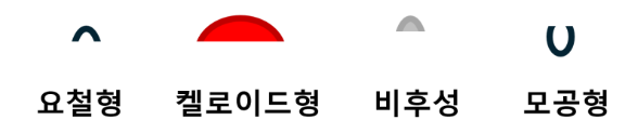 여드름흉터 종류 (4).png