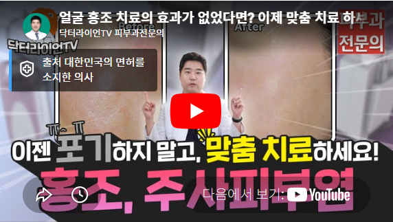 홍조레이저 (7).png