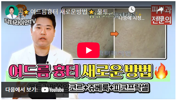 롤링흉터 박스흉터 여드름흉터 (5).png