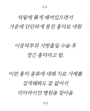 턱 지방흡입 수술흉터 (8).png