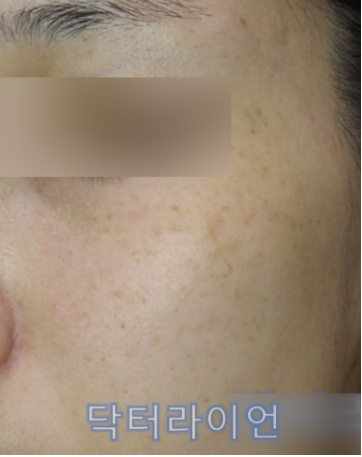 기미종류 (3).png