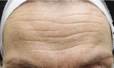 리투오콜라겐부스터 (3).png