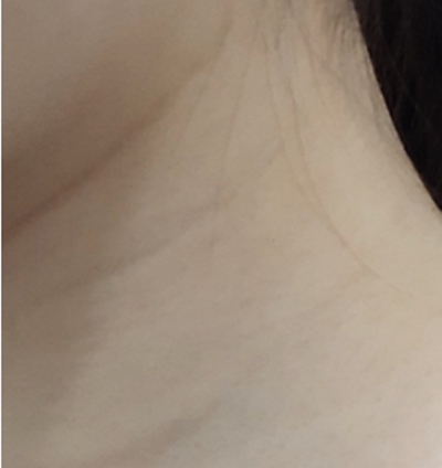리투오콜라겐부스터 (10).png