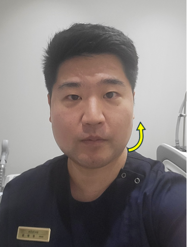 인모드 온다 지방분해효과 (5).png