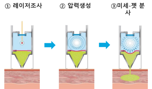 레이저토닝 (7).png