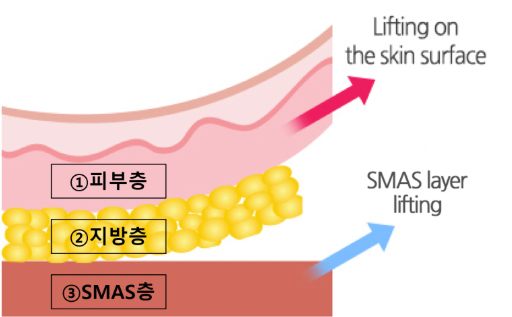 팔자주름 가장 효과 좋은건 (10).jpg