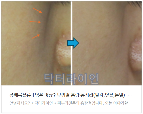 쥬베룩아이 쥬베룩볼륨 차이 (5).png