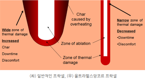팔흉터 수술흉터 봉합흉터 다친흉터제거 레이저 치료 (4).jpg