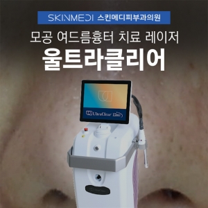 모공·여드름흉터 치료, 울트라클리어 레이저 효과 특징