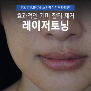 청담동피부과 레이저토닝10회 가격(비용)의 특징
