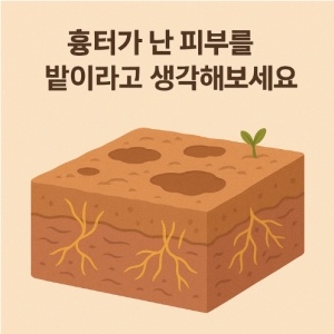 여드름흉터 치료 분류 총정리 *개념정리편*_박피성&비박피성레이저/서브시전/TCA도트필/쥬베룩